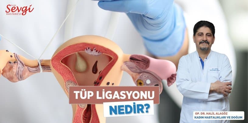 Tüp Bağlama (Tüp Ligasyonu): Kalıcı Doğum Kontrol Yöntemi