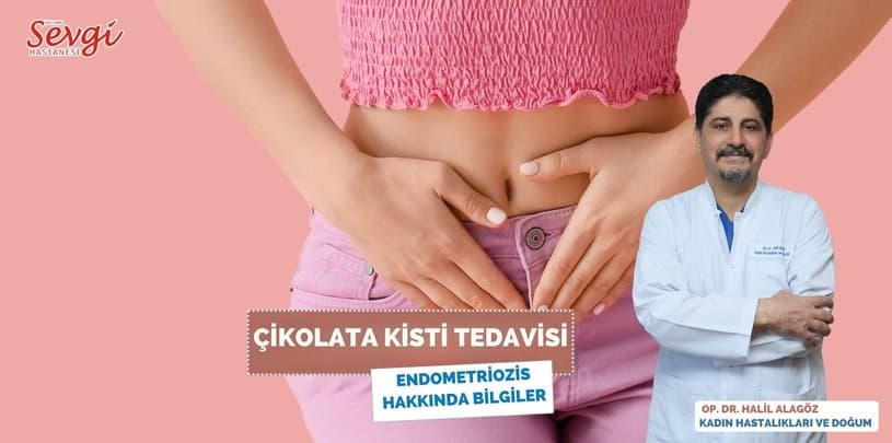 Çikolata Kisti Tedavisi: Endometriozis Hakkında Bilgilendirici Rehber